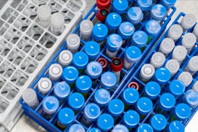 коронавирус,пробирки