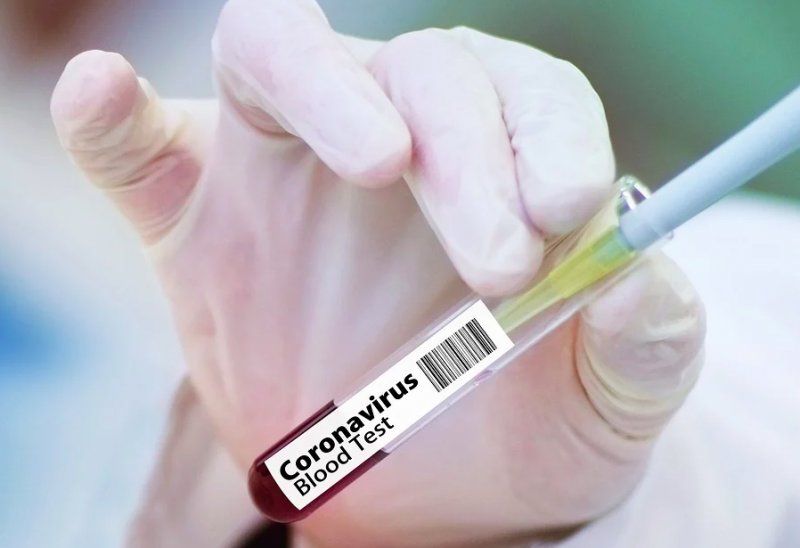 "Пациентов уже нигде не берут": врач предупредил о катастрофе из-за Covid-19