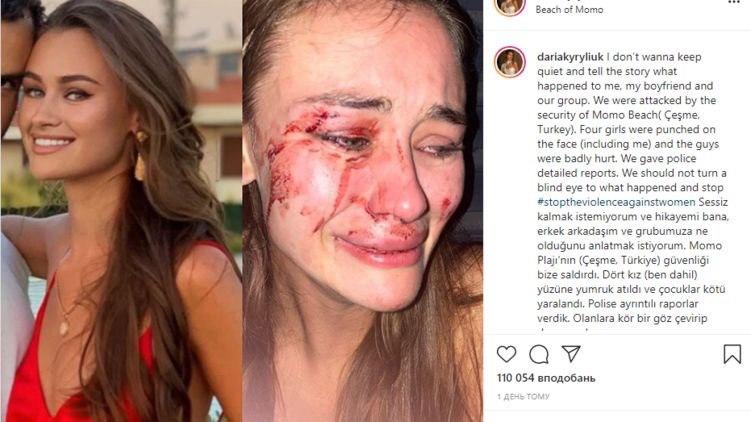 В Турции жестоко избили известную топ-модель из Украины