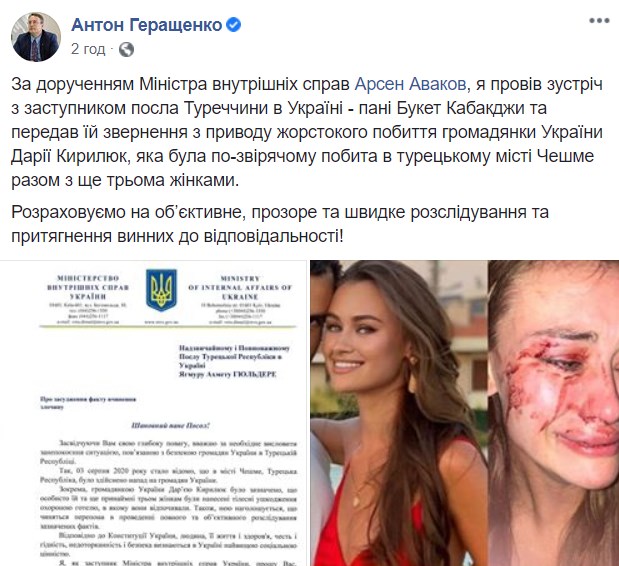 Зверское избиение украинской топ-модели на курорте: МВД передало обращение Турции