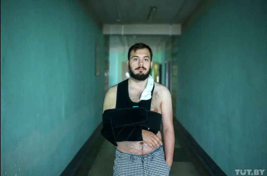 Травми протестувальників в Білорусі Травми протестувальників в Білорусі