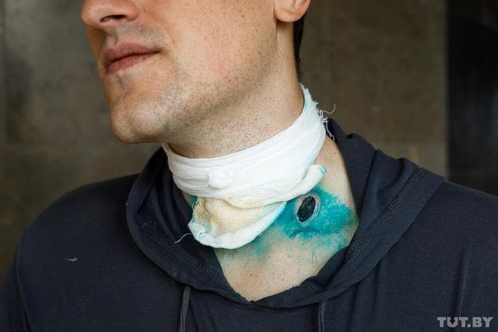 Кульові поранення активістів в Білорусі