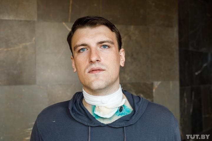 Кульові поранення активістів в Білорусі