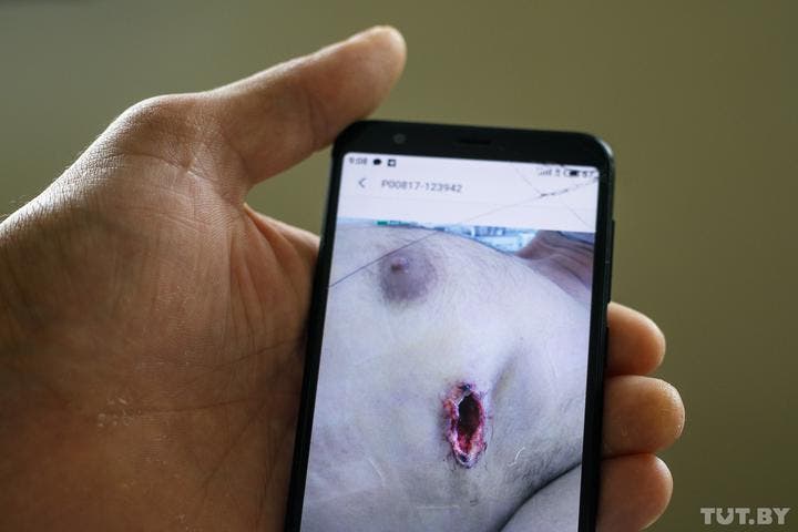 Кульові поранення активістів в Білорусі