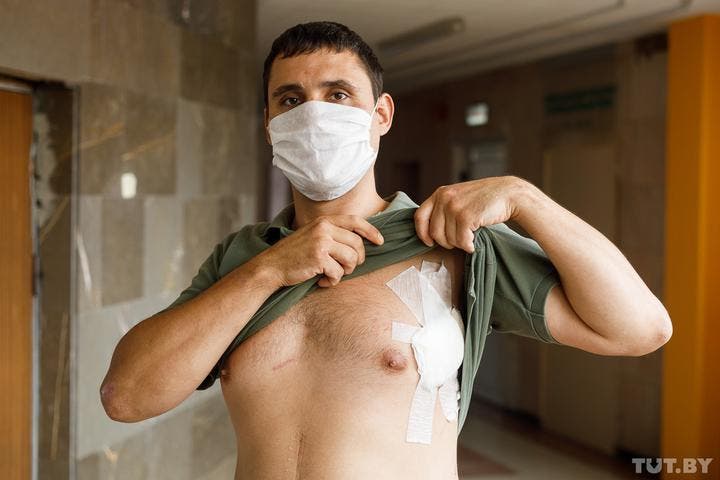 Кульові поранення активістів в Білорусі