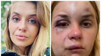 Лугову побили і намагалися зґвалтувати в поїзді / Фото facebook.com/anastaisha.lygova Лугову побили і намагалися зґвалтувати в поїзді / Фото facebook.com/anastaisha.lygova