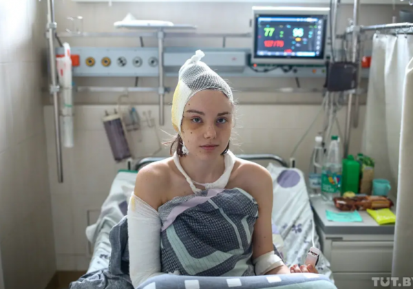 Розрив печінки, вивих плеча: в Білорусі показали безчинства силовиків