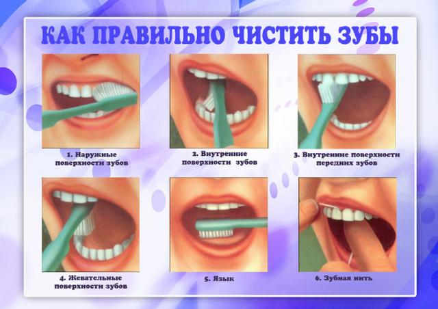 как правильно чистить зубы фото как правильно чистить зубы фото
