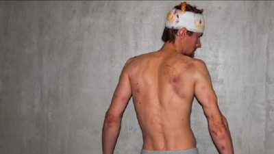 Білоруський ОМОН по-звірячому побив брата улюбленої спортсменки Лукашенка