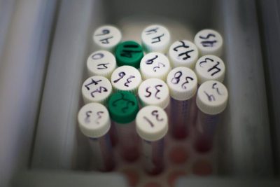 Невідома хвороба в Танзанії вбила 15 людей