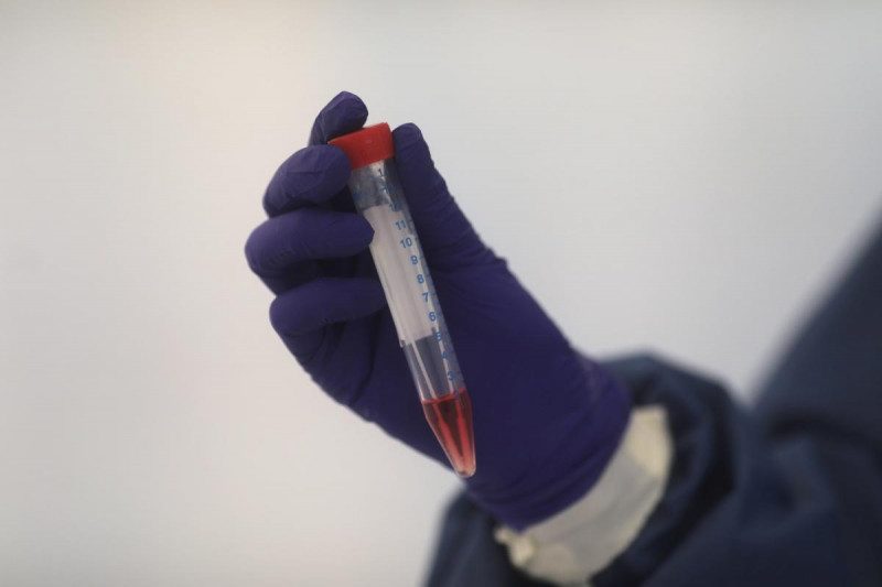 Нікуди дівати небіжчиків: похоронні бюро Іспанії б'ють на сполох