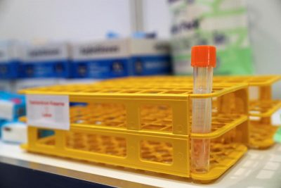 Кількість смертей від COVID-19 в Україні перевалила за 85 тисяч