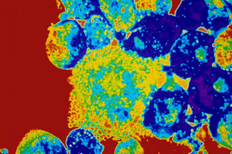 В США из-за климата распространяется амеба, разрушающая мозг