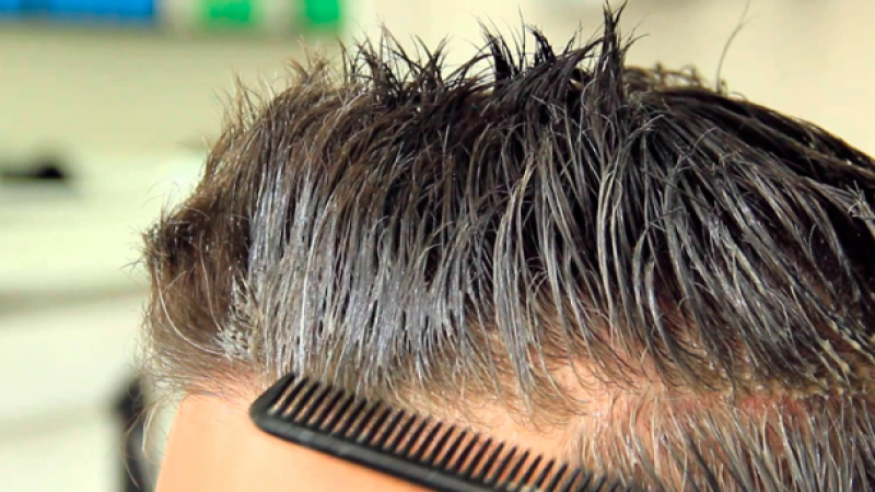 Медики объяснили, чего стоит опасаться лысым и седым мужчинам