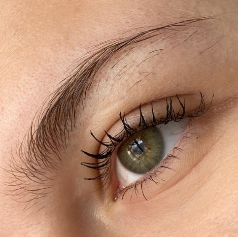 Лишние волоски старят лицо / Instagram