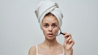 Названы продукты которые вызывают прыщи на лице