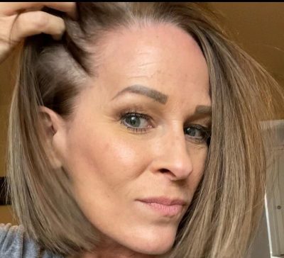 Чому сивіє волосся і чи можна його висмикувати Чому сивіє волосся і чи можна його висмикувати