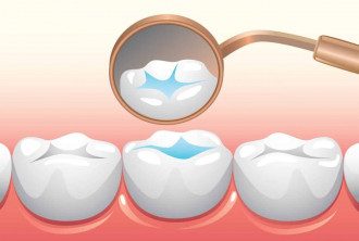 как лечить зубы как лечить зубы