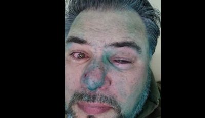 "С*икуни!": скандального блогера Коцабу "вмили" зеленкою в Івано-Франківську