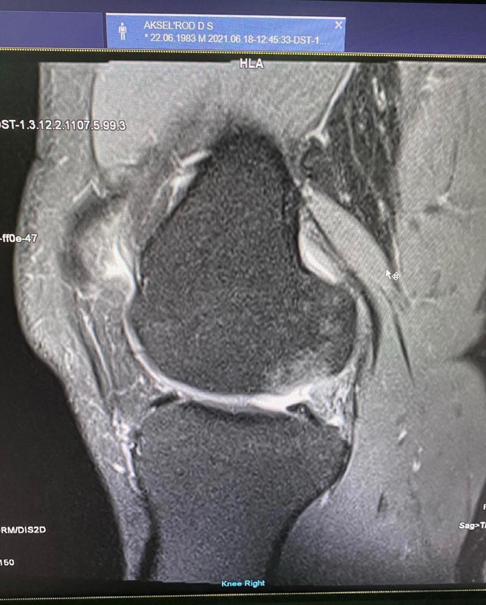 Дэвид Аксельрод сделал МРТ Дэвид Аксельрод сделал МРТ
