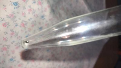 У мешканки Сумщини з-під пломби витягли небезпечного кліща У мешканки Сумщини з-під пломби витягли небезпечного кліща