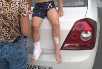 У київському ТРЦ на дитину впала вітрина: у хлопчика тріщина на нозі