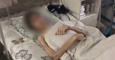 Гематоми на тілі і церковне масло: з'явилися моторошні подробиці про виснаженого підлітка в Одесі Гематоми на тілі і церковне масло: з'явилися моторошні подробиці про виснаженого підлітка в Одесі