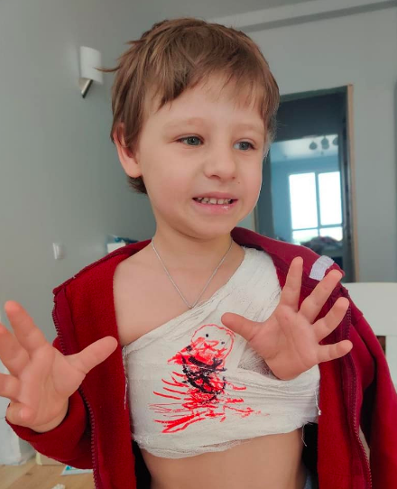 Ребенок получил перелом ключицы Ребенок получил перелом ключицы