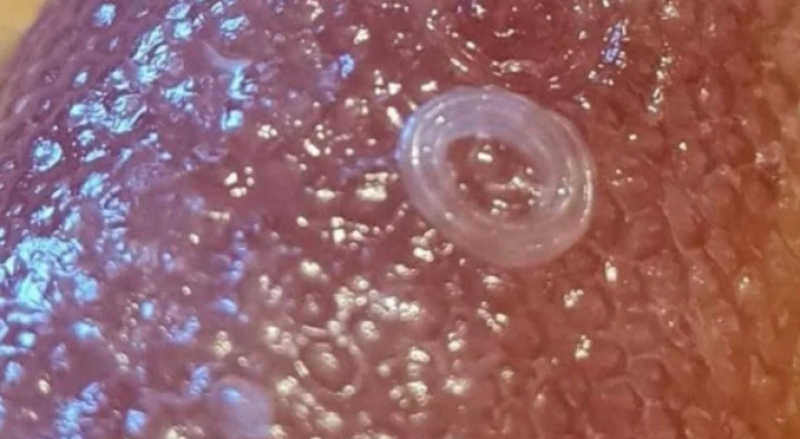 В Киеве покупателям попалась селедка с червями-паразитами