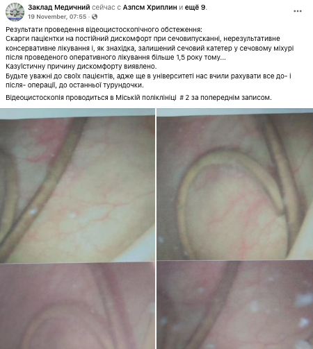 Страшні болі: у жінки дістали катетер, який після операції 'забули' лікарі