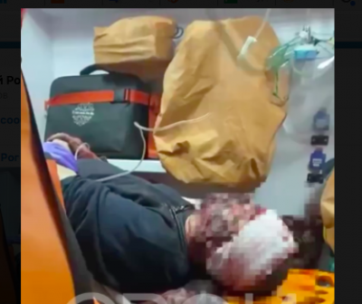 У Кривому Розі чоловік вистрілив собі в голову і вижив У Кривому Розі чоловік вистрілив собі в голову і вижив