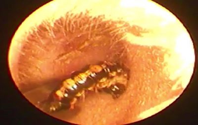 У вусі чоловіка жив черв'як У вусі чоловіка жив черв'як