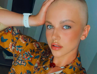 Українська гімнастка шокувала фігурою після страшної хвороби