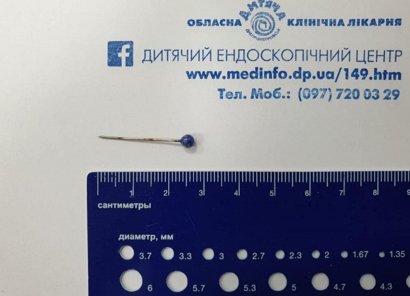У Дніпрі дитина проковтнула шпильку: як рятували малюка