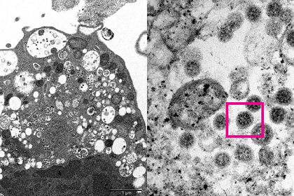 Ученые сфотографировали штамм коронавируса Омикрон