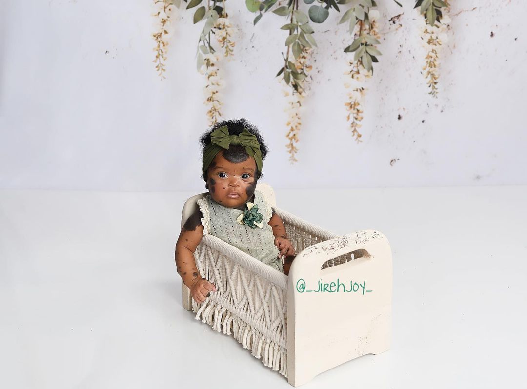 Піврічна дівчинка з унікальними темними плямами стала зіркою Instagram - щемливі фото