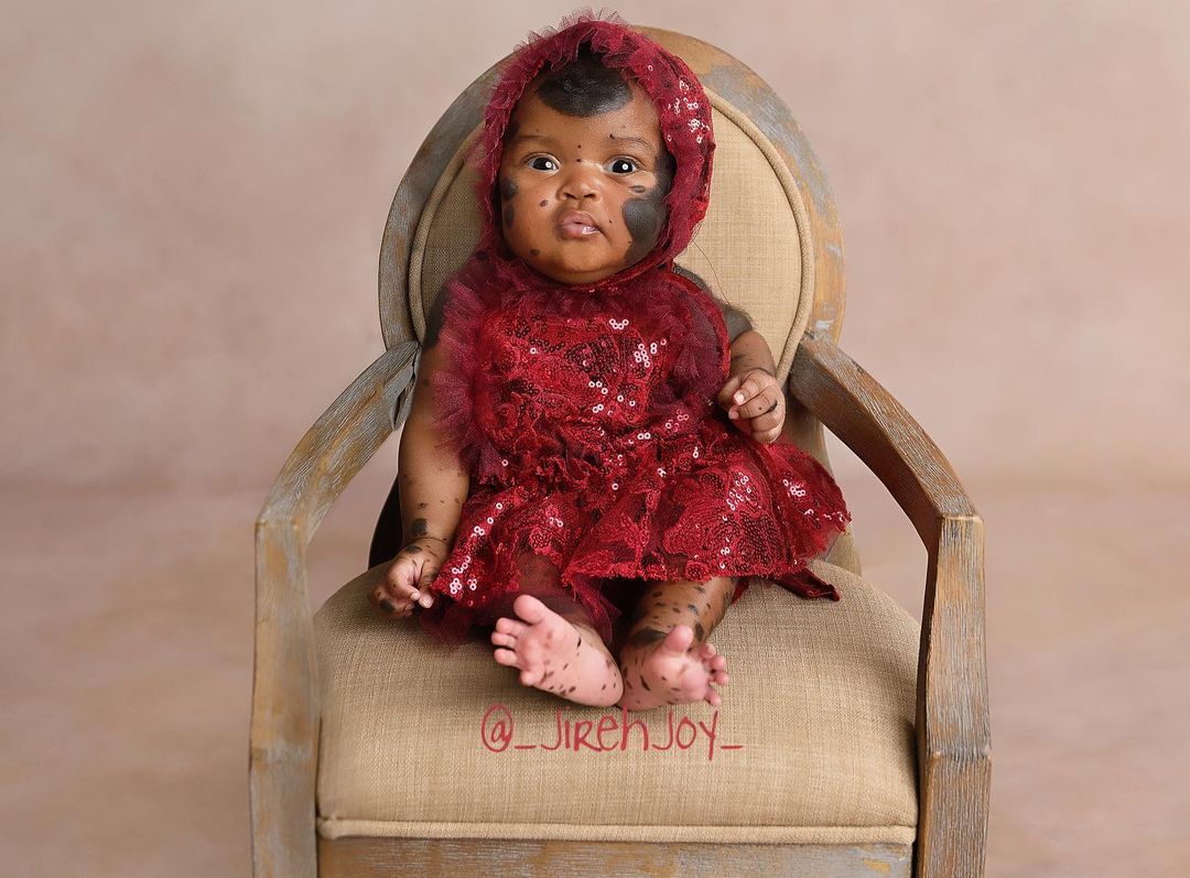 Піврічна дівчинка з унікальними темними плямами стала зіркою Instagram - щемливі фото