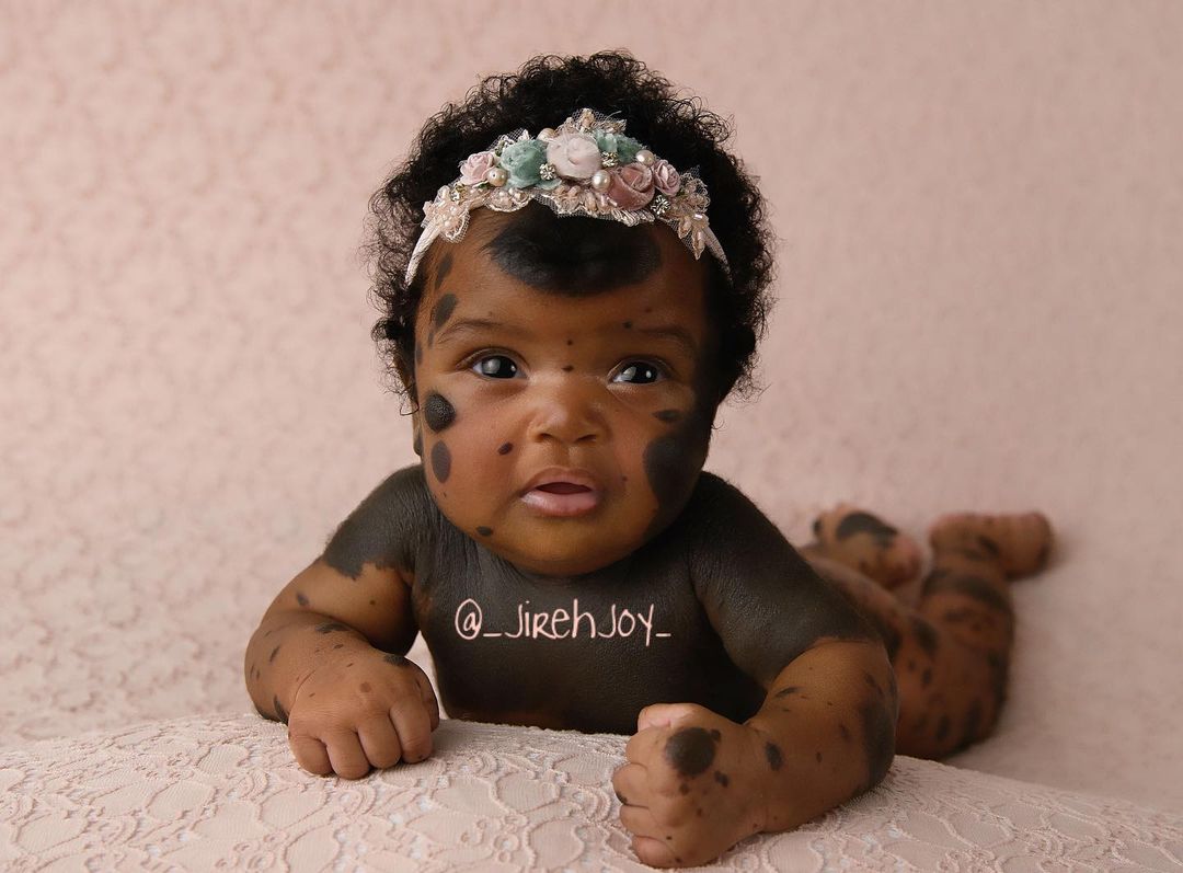 Піврічна дівчинка з унікальними темними плямами стала зіркою Instagram - щемливі фото