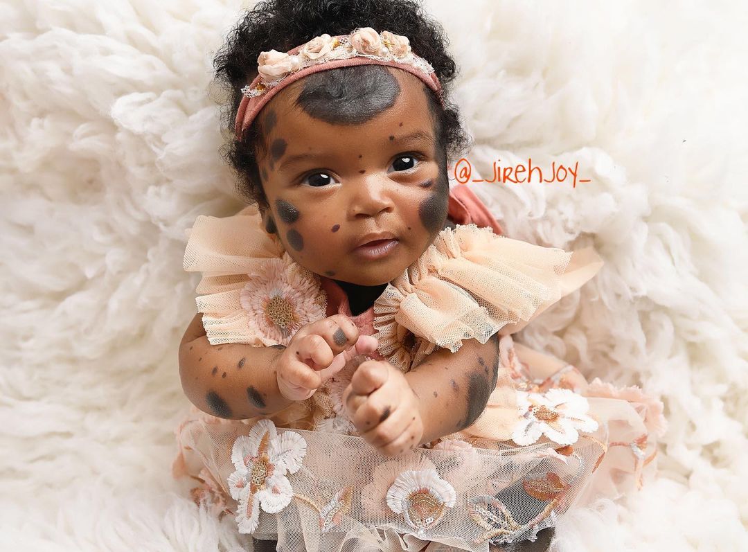 Піврічна дівчинка з унікальними темними плямами стала зіркою Instagram - щемливі фото