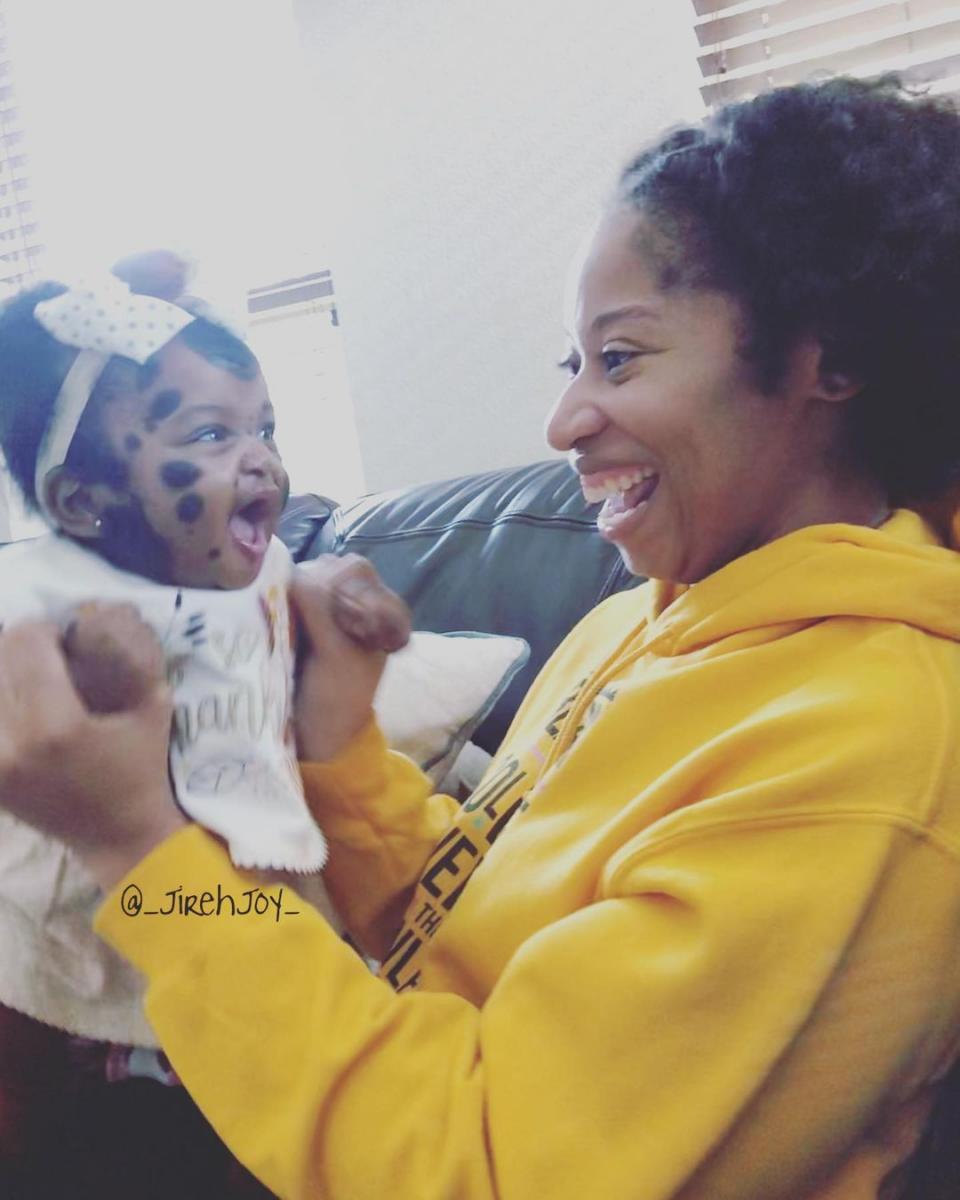 Піврічна дівчинка з унікальними темними плямами стала зіркою Instagram - щемливі фото