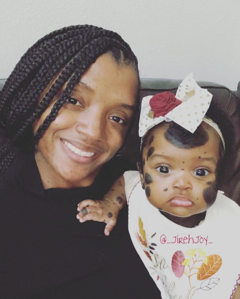 Піврічна дівчинка з унікальними темними плямами стала зіркою Instagram - щемливі фото