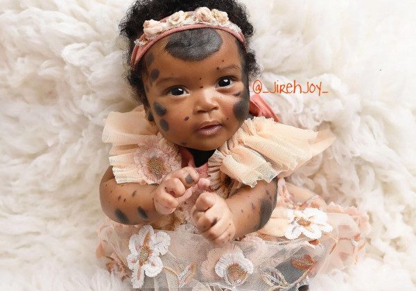 Піврічна дівчинка з унікальними темними плямами стала зіркою Instagram - щемливі фото