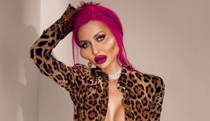 Украинка с самыми большими скулами в мире показала себя в 16 лет до пластик и филлеров