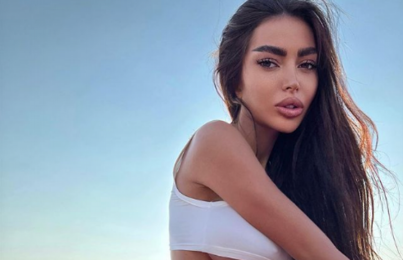 "Українську Кім Кардашьян" захейтили фанати через дивний зовнішній вигляд після невдалої пластики