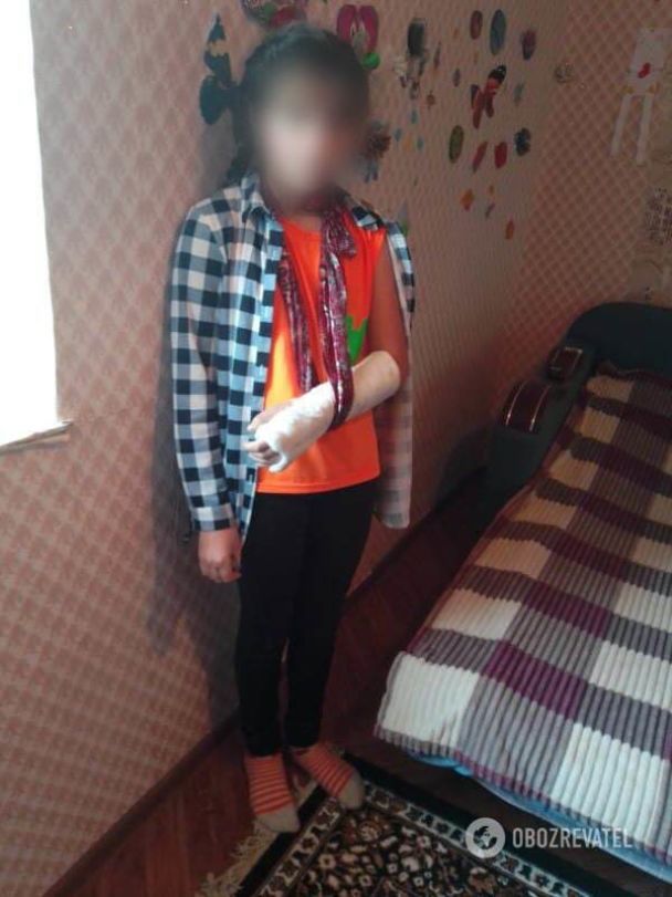 В одесской школе девочка сломала руку: учительница приложила рыбу и отправила на уроки