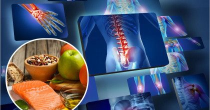 Какие продукты по-максимуму укрепляют суставы - комментарий диетолога