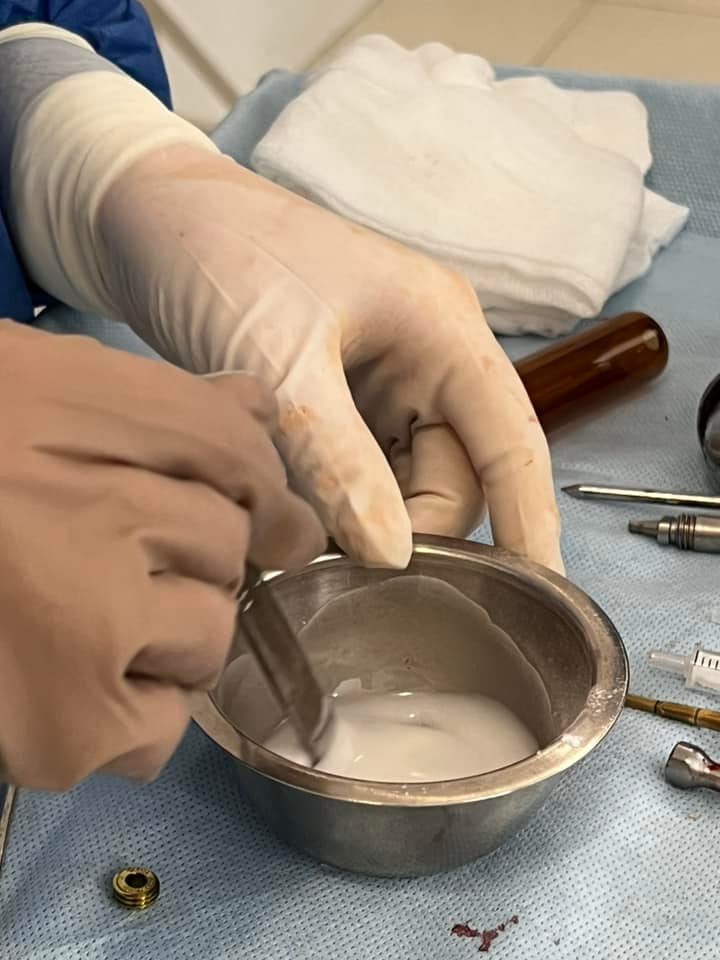 Украинка 3 месяца ходила со сломанным хребтом, не зная об этом