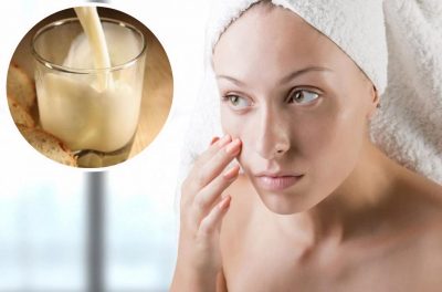 Вони є у кожному холодильнику: які продукти викликають прищі