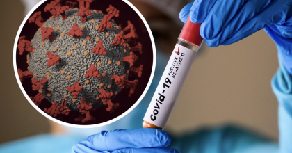 У Києві новий спалах коронавірусу: як розпізнати симптоми штаму Stratus