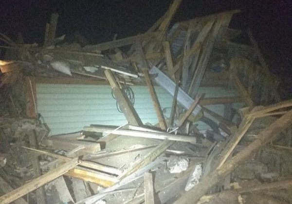 3-річному хлопчику відірвало ногу: наслідки бомбардування Коростеня на Житомирщині